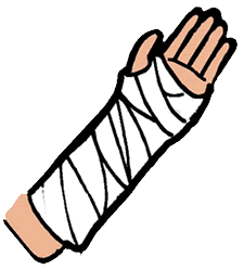 arm cast clip art