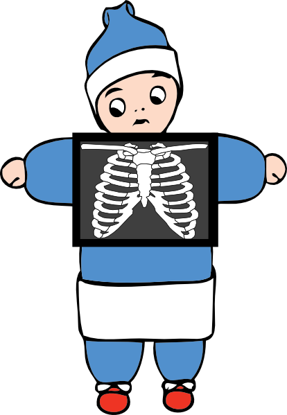 Pediatric Chest X-Ray Education - Understanding Rib Anatomy for Kids