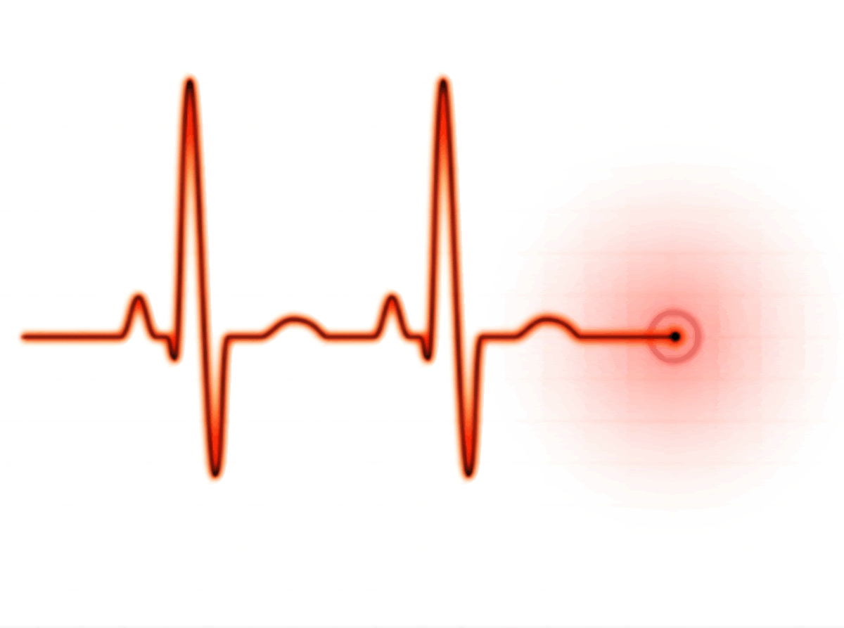 Red ECG waveform with a pulsating red hotspot indicating cardiac activity or anomaly on white background.