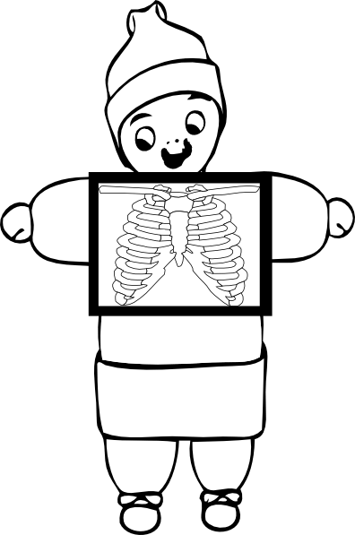 black and white x ray clip art