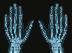 Human Hand X-Ray: Anatomy, Medical Imaging & Diagnostic Use