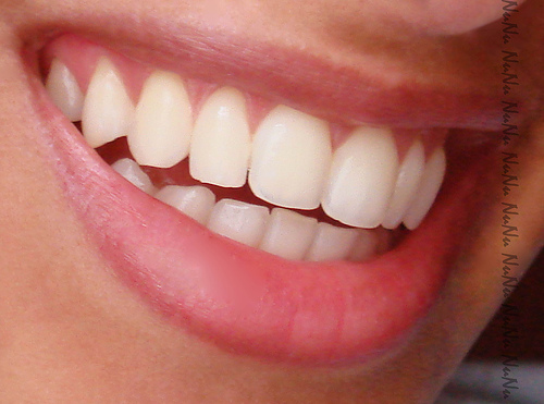 Close-up of a bright, healthy smile with white teeth and pink gums