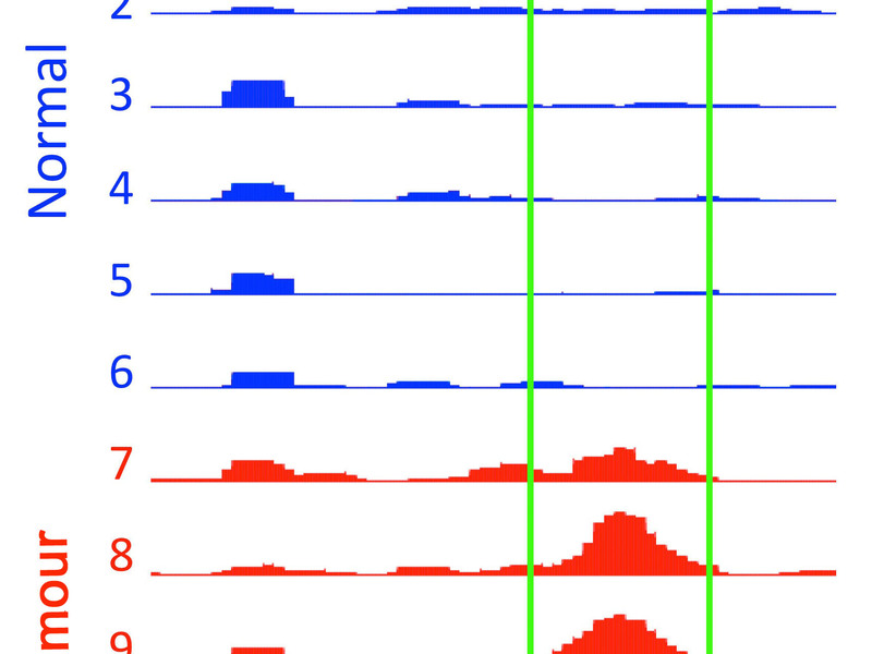 Histogram comparison of normal vs tumour gene expression levels across 9 samples, with green vertical lines marking thresholds.