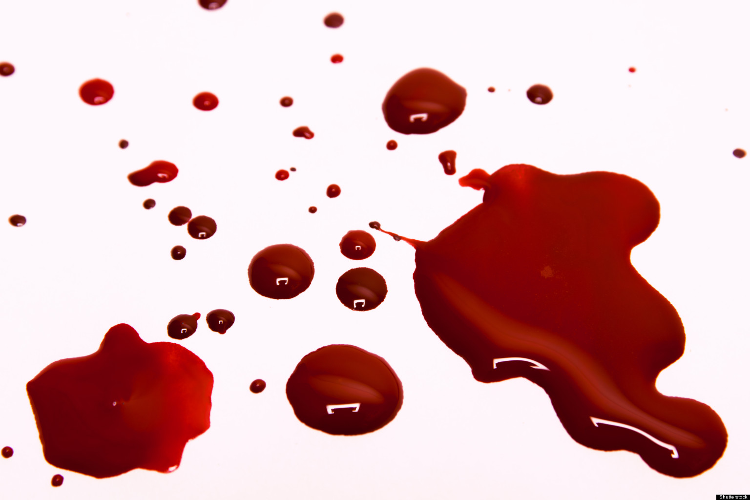 Real-Life 'Vampire' Is Addicted To Drinking Blood  Has Multiple 