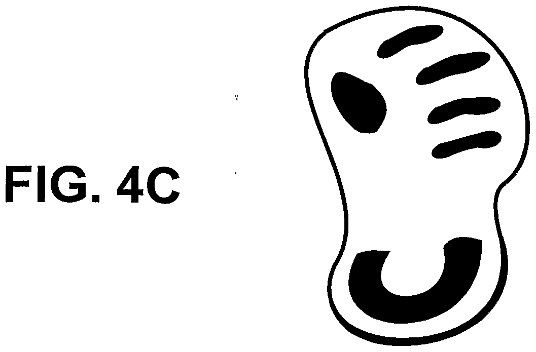 Foot Pressure Distribution Diagram - FIG. 4C