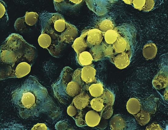 Electron Microscope Image of Viral Infection on Host Cells