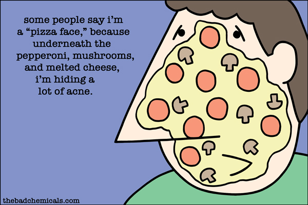 Pizza Face Meme - Why People Call It That (and the Acne Joke)