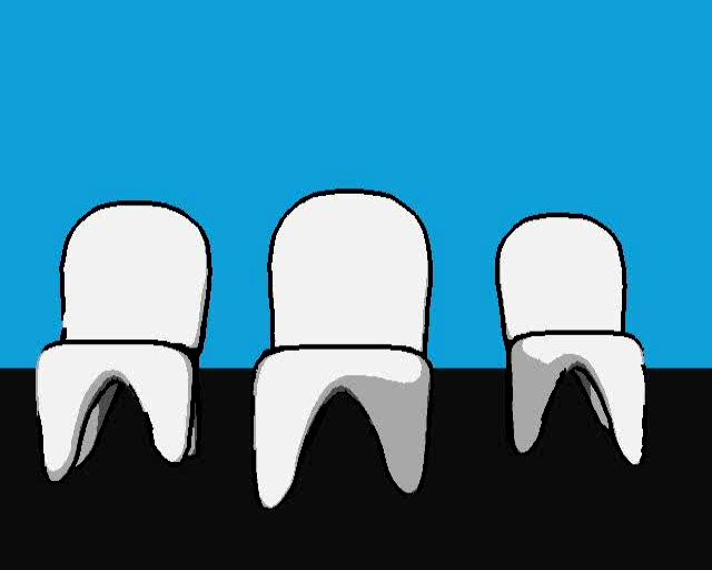 Understanding Molar Teeth: Structure, Function, and Oral Health