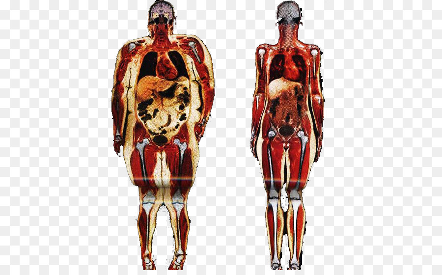 Obesity Human body Adipose tissue Anatomy Connective tissue - health png download - 580*550 - Free Transparent  png Download.