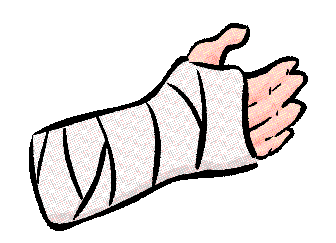 broken arm cast cartoon