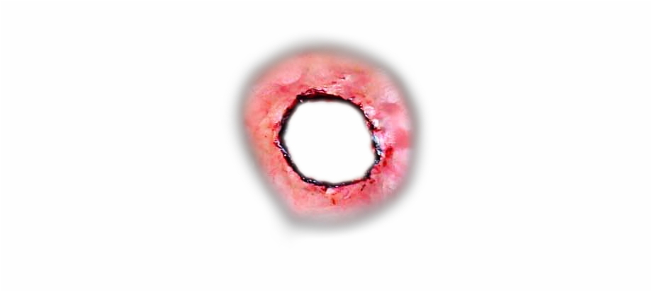 Wound Ferita Hole Blood Sticker By Go Hole
