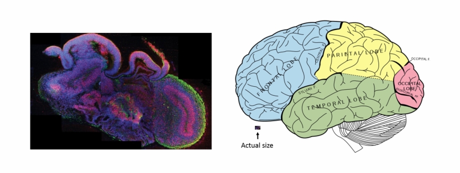 Transparent Brain Model Human Brain Organoids