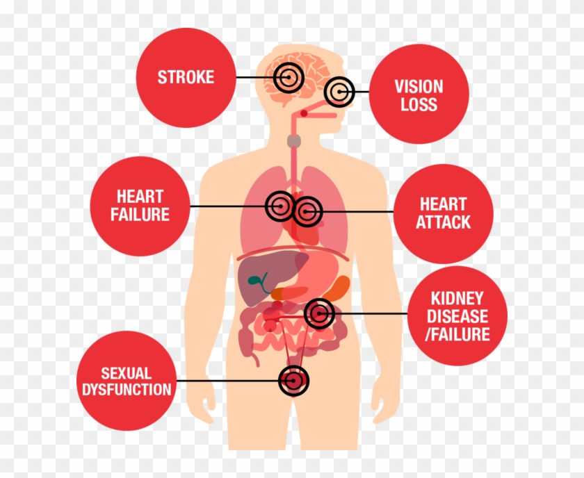 Free Health Risk Cliparts, Download Free Health Risk Cliparts png