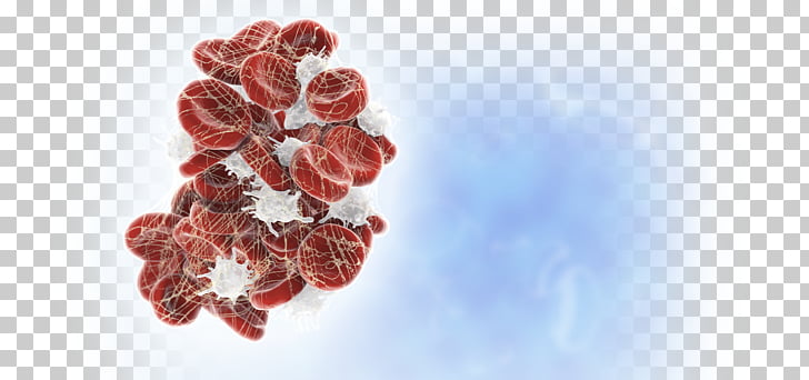 Red blood cells clustered with white blood cells and platelets in a blood clot formation